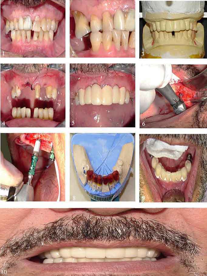 reconstrucion-oral2-reportemedico